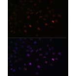Immunofluorescence - Anti-SRSF3 Antibody (A81004) - Antibodies.com