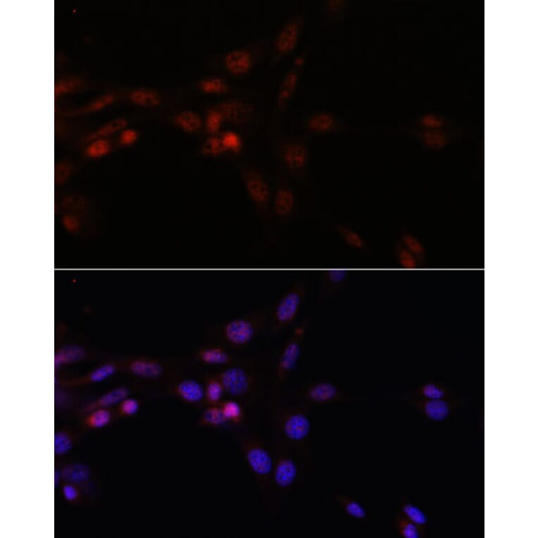 Immunofluorescence - Anti-SRSF3 Antibody (A81004) - Antibodies.com
