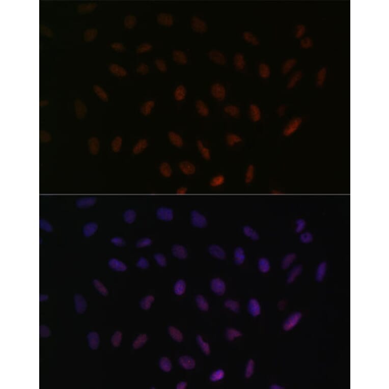 Immunofluorescence - Anti-SRSF3 Antibody (A81004) - Antibodies.com