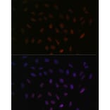Immunofluorescence - Anti-SRSF3 Antibody (A81004) - Antibodies.com