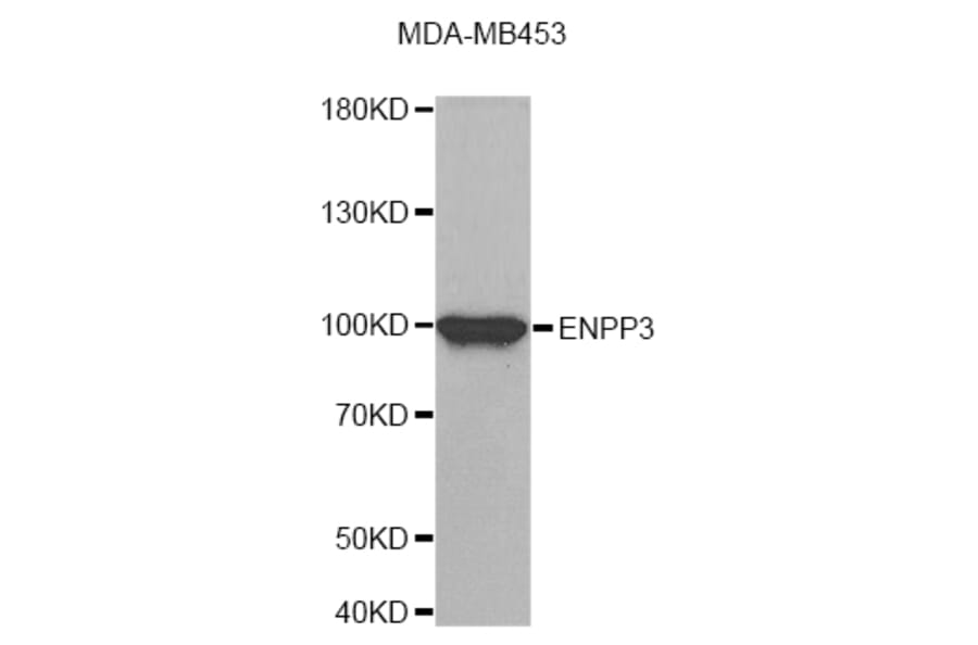 Western Blot - Anti-ENPP3 Antibody (A8042) - Antibodies.com