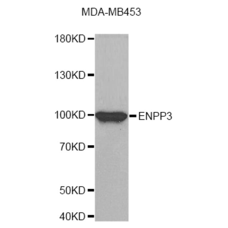 Western Blot - Anti-ENPP3 Antibody (A8042) - Antibodies.com