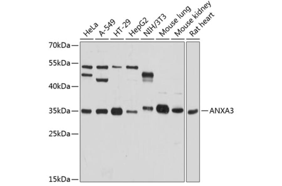 Western Blot - Anti-Annexin A3/ANXA3 Antibody (A81006) - Antibodies.com