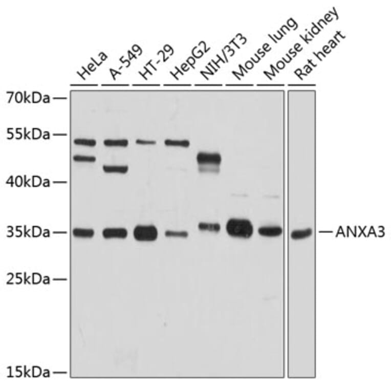 Western Blot - Anti-Annexin A3/ANXA3 Antibody (A81006) - Antibodies.com