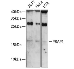 Western Blot - Anti-PRAP1 Antibody (A81007) - Antibodies.com