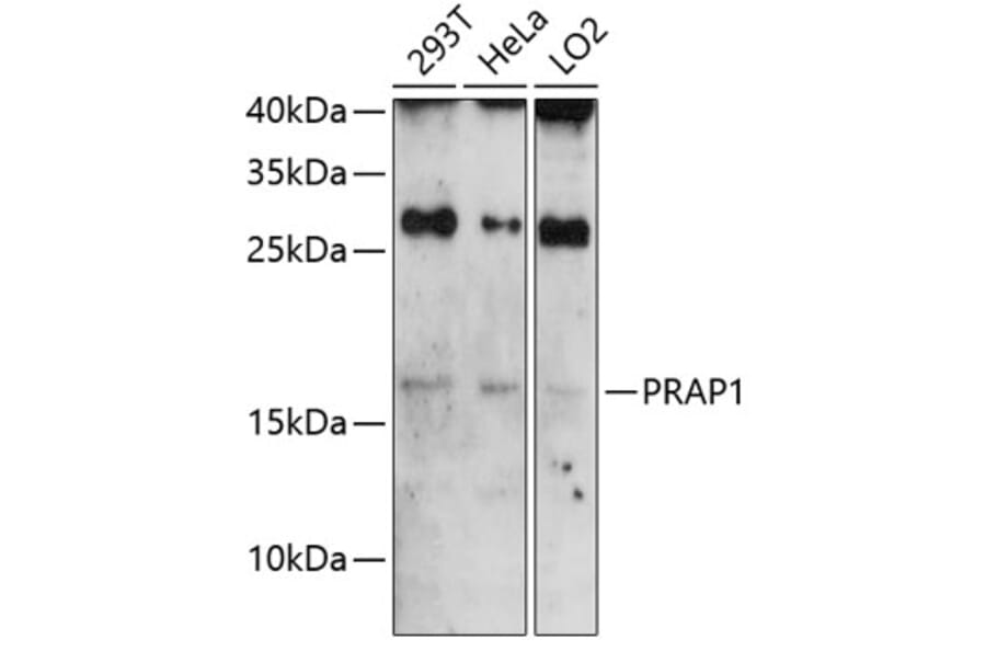 Western Blot - Anti-PRAP1 Antibody (A81007) - Antibodies.com