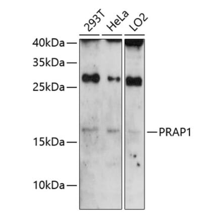 Western Blot - Anti-PRAP1 Antibody (A81007) - Antibodies.com