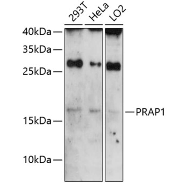 Western Blot - Anti-PRAP1 Antibody (A81007) - Antibodies.com