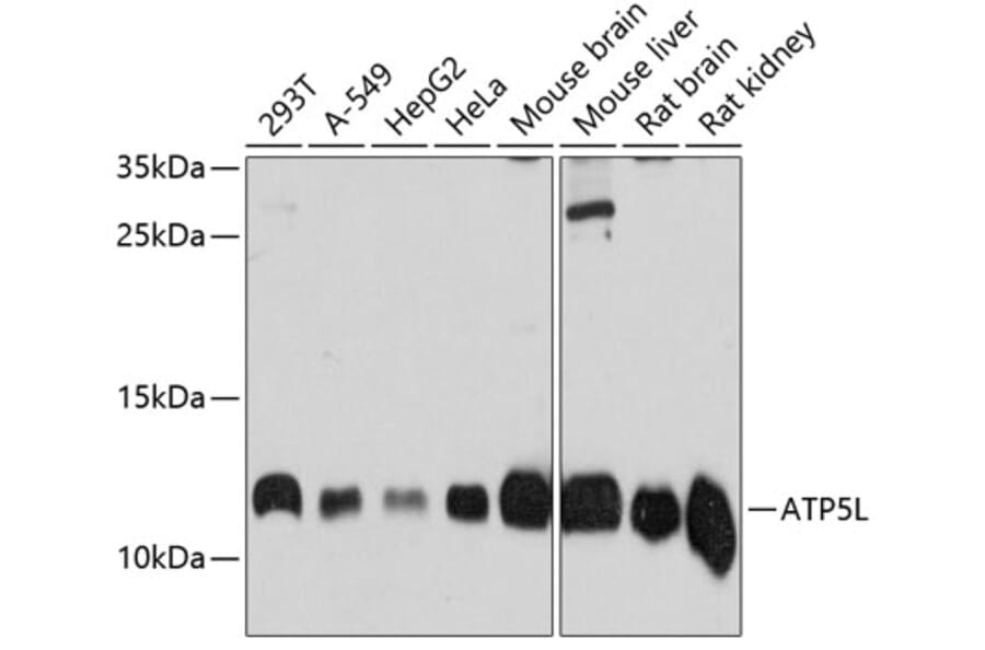 Western Blot - Anti-ATP5L2/ATP5L Antibody (A81008) - Antibodies.com