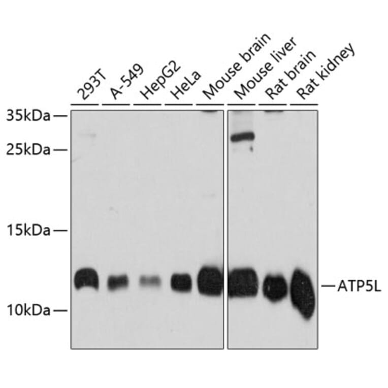 Western Blot - Anti-ATP5L2/ATP5L Antibody (A81008) - Antibodies.com