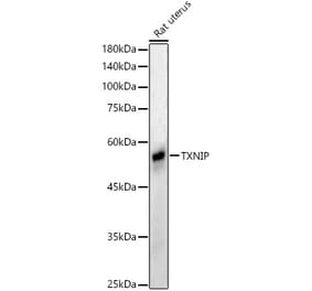 Western Blot - Anti-TXNIP Antibody (A81009) - Antibodies.com