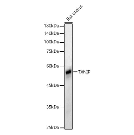 Western Blot - Anti-TXNIP Antibody (A81009) - Antibodies.com