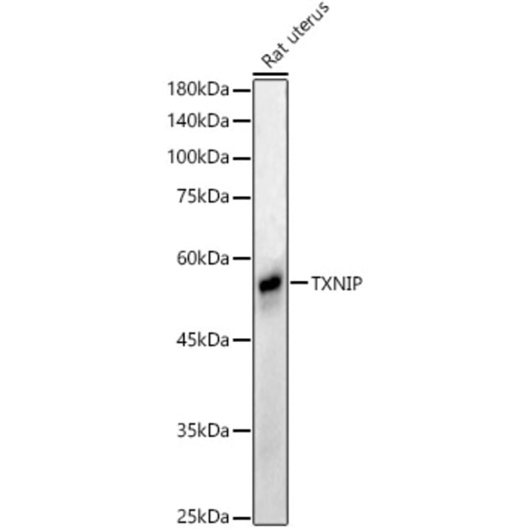 Western Blot - Anti-TXNIP Antibody (A81009) - Antibodies.com