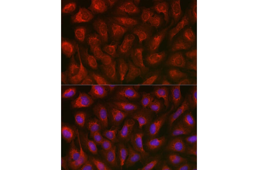 Immunofluorescence - Anti-TXNIP Antibody (A81009) - Antibodies.com