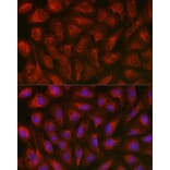 Immunofluorescence - Anti-TXNIP Antibody (A81009) - Antibodies.com