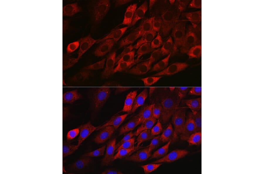 Immunofluorescence - Anti-TXNIP Antibody (A81009) - Antibodies.com