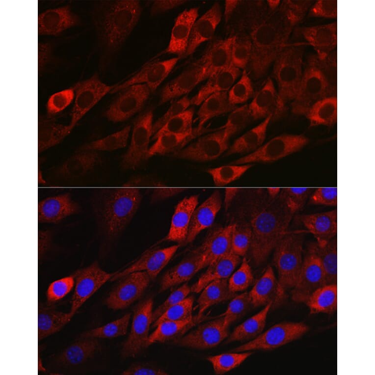 Immunofluorescence - Anti-TXNIP Antibody (A81009) - Antibodies.com