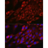 Immunofluorescence - Anti-TXNIP Antibody (A81009) - Antibodies.com