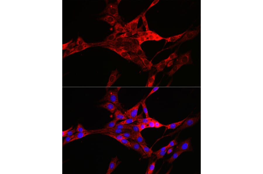 Immunofluorescence - Anti-TXNIP Antibody (A81009) - Antibodies.com