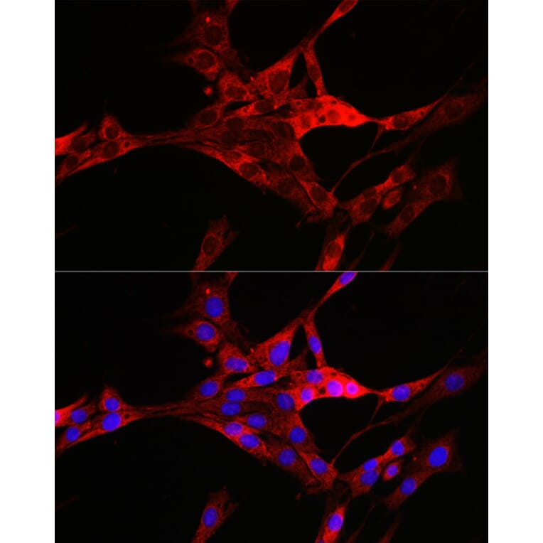 Immunofluorescence - Anti-TXNIP Antibody (A81009) - Antibodies.com