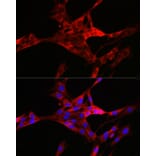 Immunofluorescence - Anti-TXNIP Antibody (A81009) - Antibodies.com