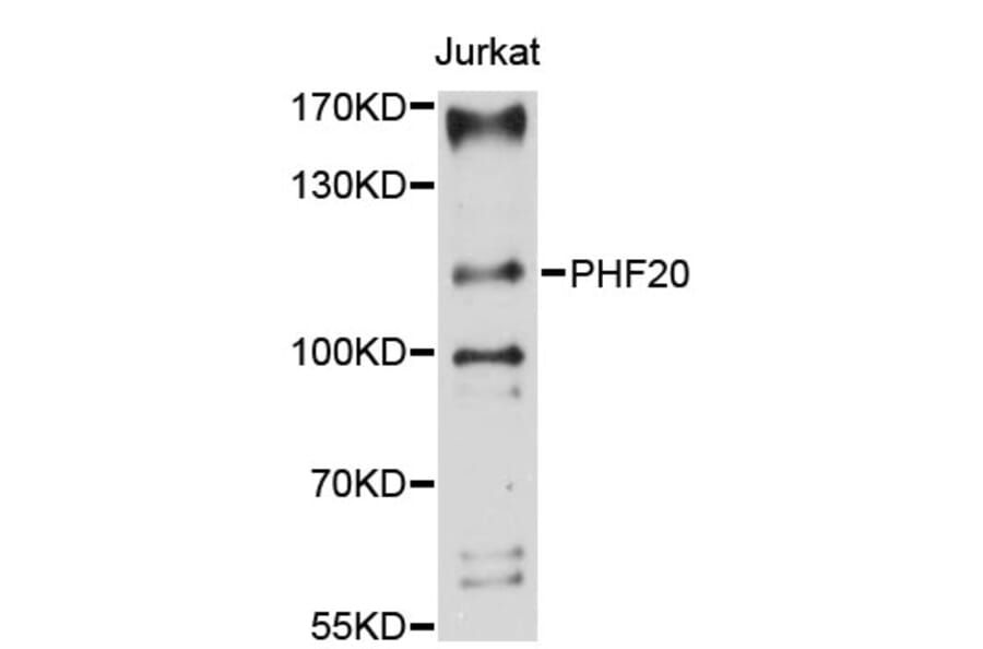 Western Blot - Anti-PHF20 Antibody (A9489) - Antibodies.com