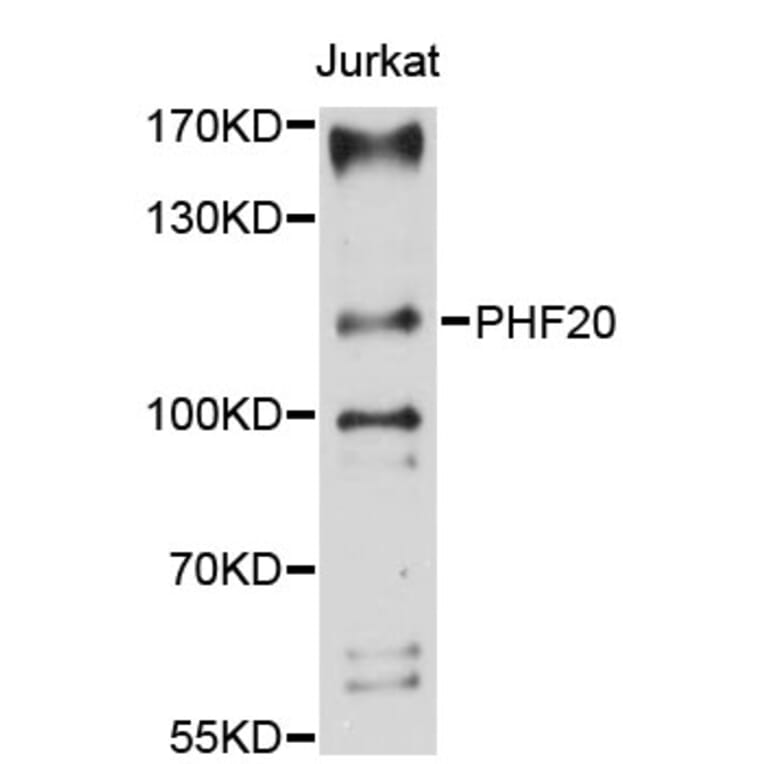 Western Blot - Anti-PHF20 Antibody (A9489) - Antibodies.com