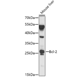 Western Blot - Anti-Bcl-2 Antibody (A81011) - Antibodies.com