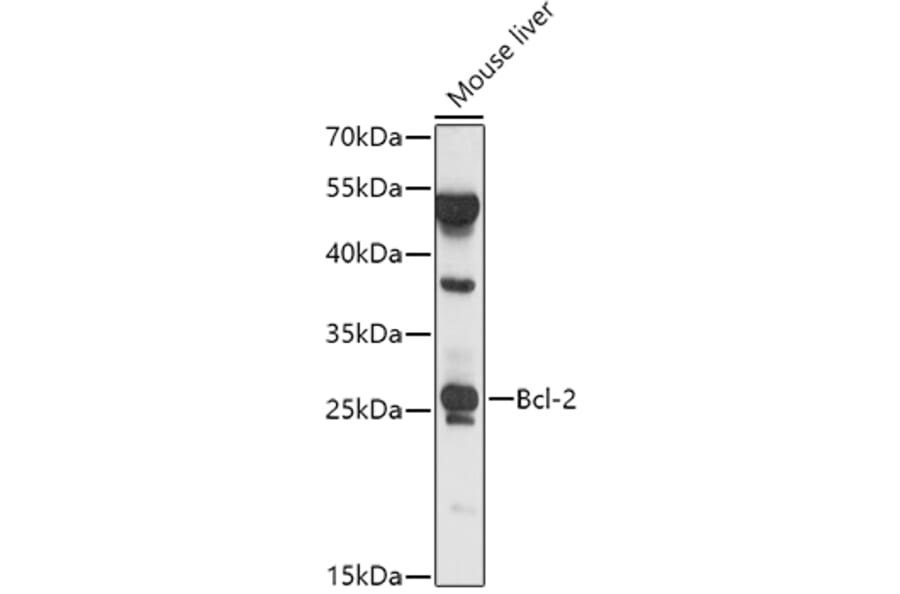 Western Blot - Anti-Bcl-2 Antibody (A81011) - Antibodies.com