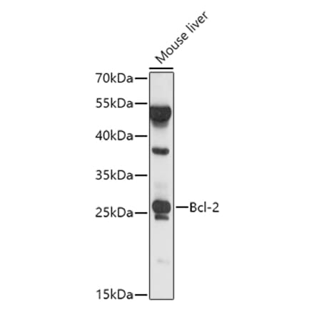 Western Blot - Anti-Bcl-2 Antibody (A81011) - Antibodies.com