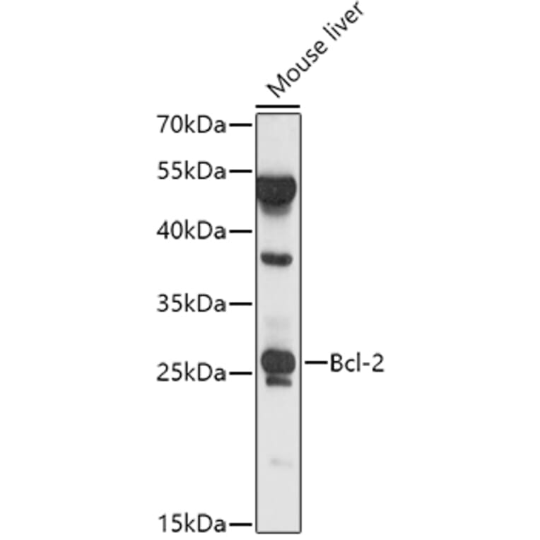 Western Blot - Anti-Bcl-2 Antibody (A81011) - Antibodies.com