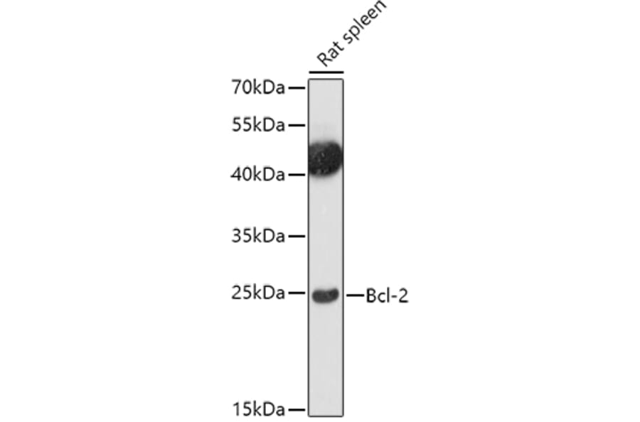 Western Blot - Anti-Bcl-2 Antibody (A81011) - Antibodies.com