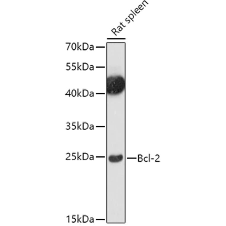 Western Blot - Anti-Bcl-2 Antibody (A81011) - Antibodies.com
