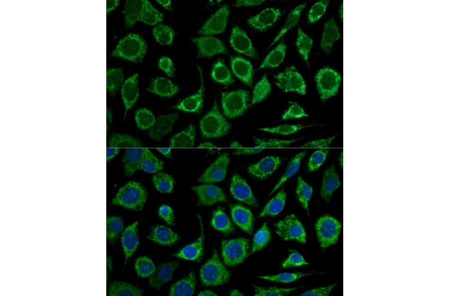 Immunofluorescence - Anti-Bcl-2 Antibody (A81011) - Antibodies.com