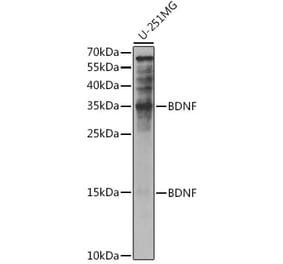 Western Blot - Anti-BDNF Antibody (A81012) - Antibodies.com