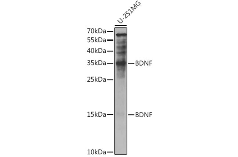Western Blot - Anti-BDNF Antibody (A81012) - Antibodies.com