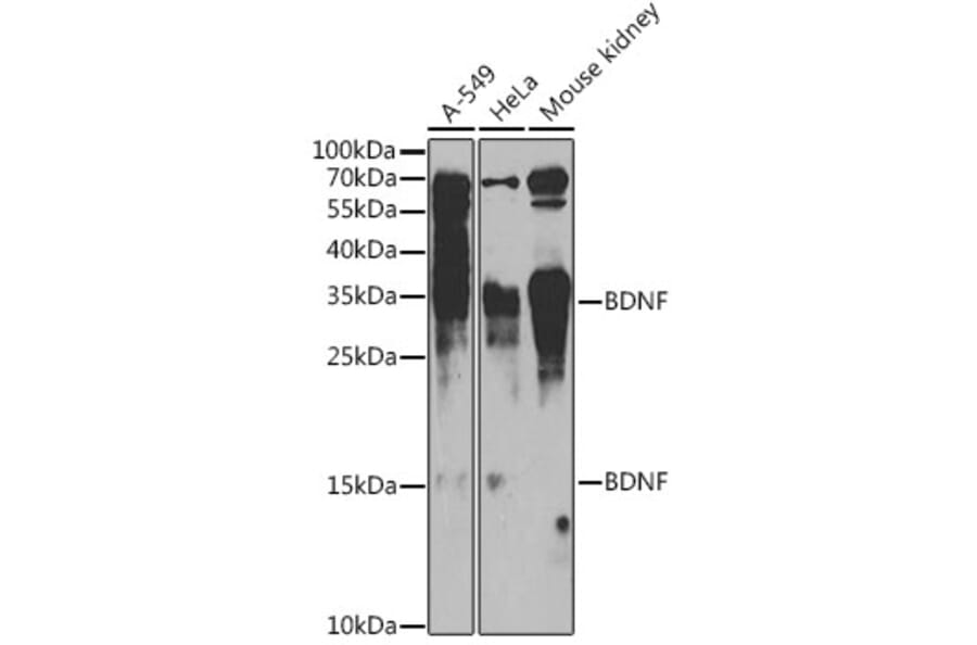 Western Blot - Anti-BDNF Antibody (A81012) - Antibodies.com