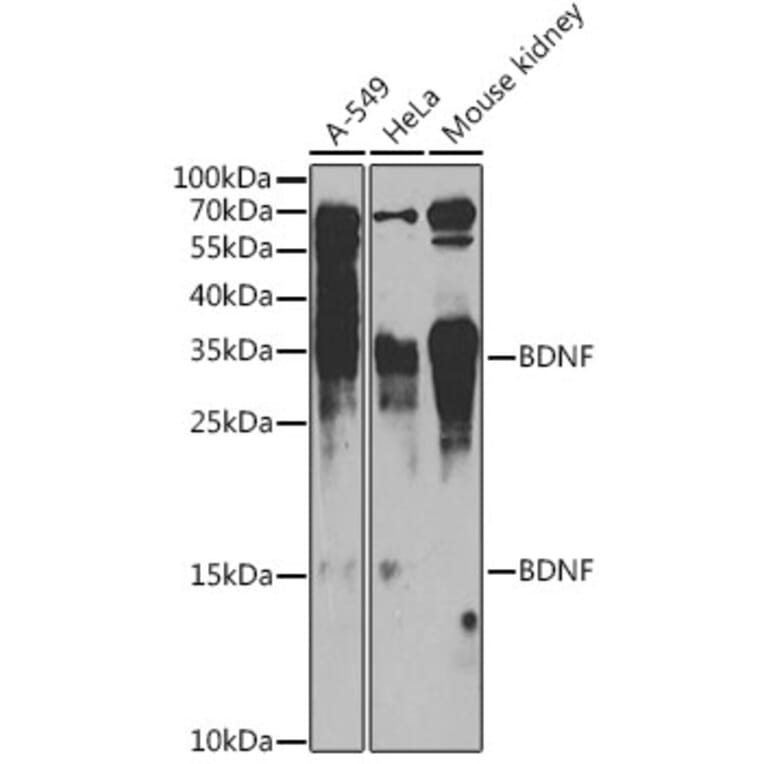 Western Blot - Anti-BDNF Antibody (A81012) - Antibodies.com