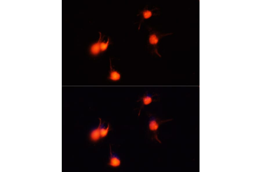 Immunofluorescence - Anti-BDNF Antibody (A81012) - Antibodies.com