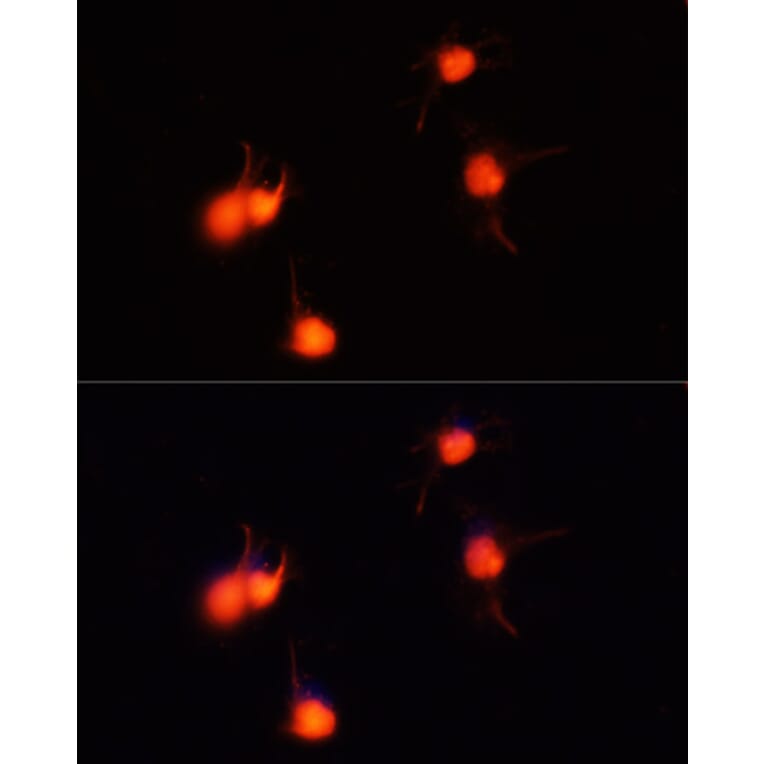 Immunofluorescence - Anti-BDNF Antibody (A81012) - Antibodies.com