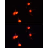 Immunofluorescence - Anti-BDNF Antibody (A81012) - Antibodies.com