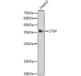 Western Blot - Anti-CTGF Antibody (A81015) - Antibodies.com