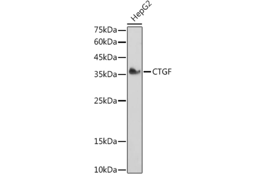 Western Blot - Anti-CTGF Antibody (A81015) - Antibodies.com