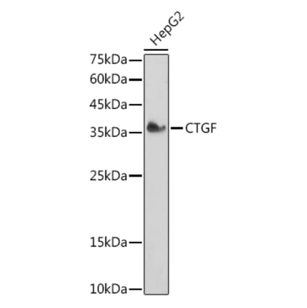 Western Blot - Anti-CTGF Antibody (A81015) - Antibodies.com
