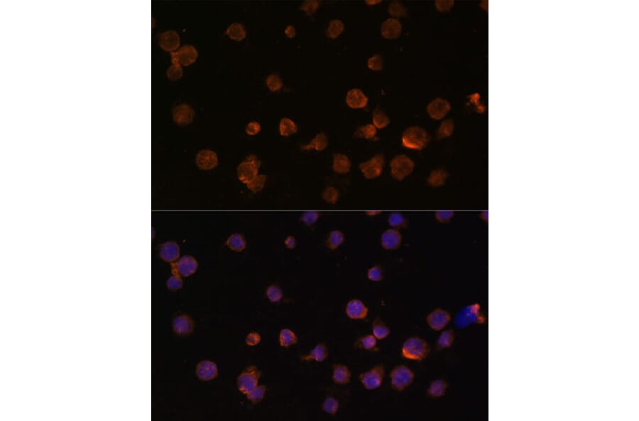 Immunofluorescence - Anti-CTGF Antibody (A81015) - Antibodies.com