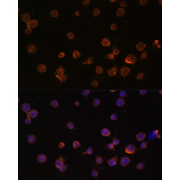 Immunofluorescence - Anti-CTGF Antibody (A81015) - Antibodies.com