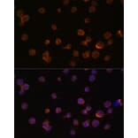 Immunofluorescence - Anti-CTGF Antibody (A81015) - Antibodies.com