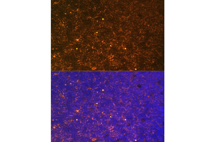 Immunofluorescence - Anti-CTGF Antibody (A81015) - Antibodies.com