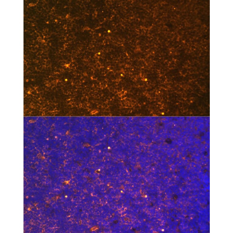 Immunofluorescence - Anti-CTGF Antibody (A81015) - Antibodies.com