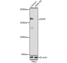 Western Blot - Anti-EGFR Antibody (A81016) - Antibodies.com